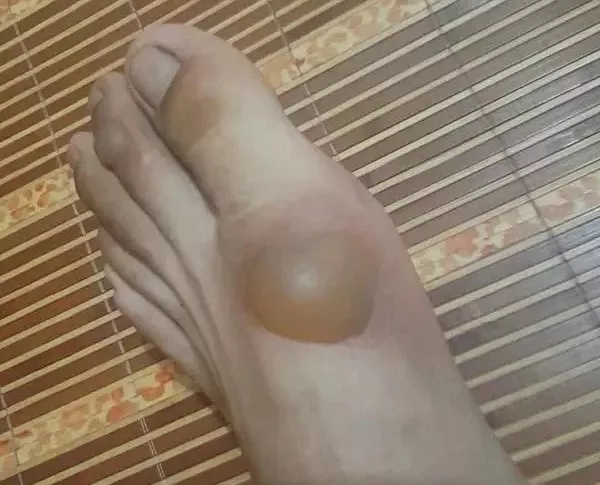 \